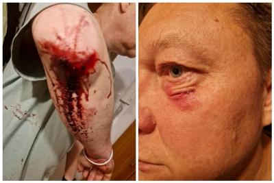 У Варшаве збілі беларуса з Віцебску